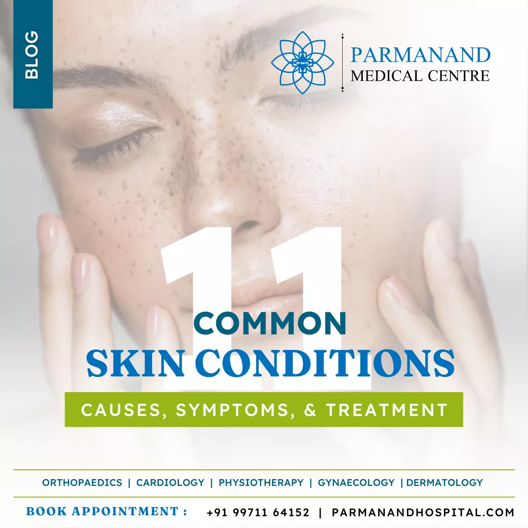 Understanding 11 Common Skin Conditions and Treatments