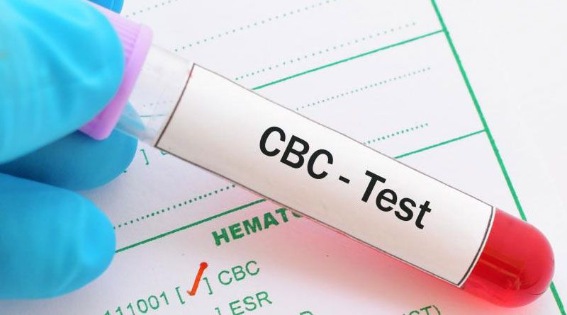 Essential Blood Tests - 1 :  Complete Blood Count (CBC): Unlocking Clues to Your Health