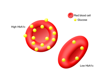 Essential Blood Tests - 4 : HbA1c: Monitoring Blood Sugar Levels Over Time
