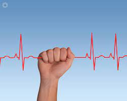 Signs of heart palpitations - Extra Beats 