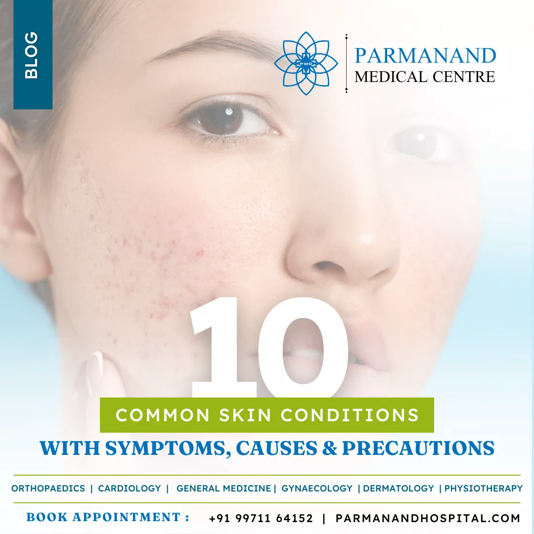 10-Skin-conditions-with-symptoms-causes-and-precautions